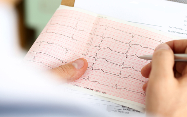 Электрокардиограмма (ЭКГ) сердца на дому в Харькове