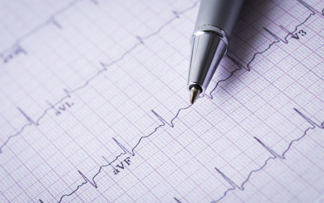 Кардиограмма сердца на дому