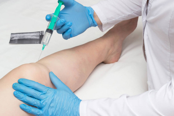 Периартикулярная блокада